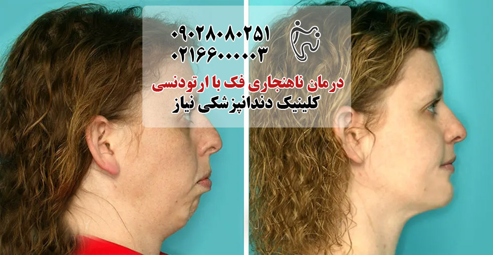 روش‌ های ارتودنسی برای درمان ناهنجاری فک