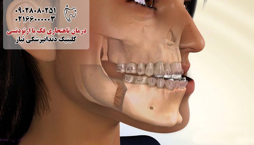 درمان ناهنجاری فک با ارتودنسی